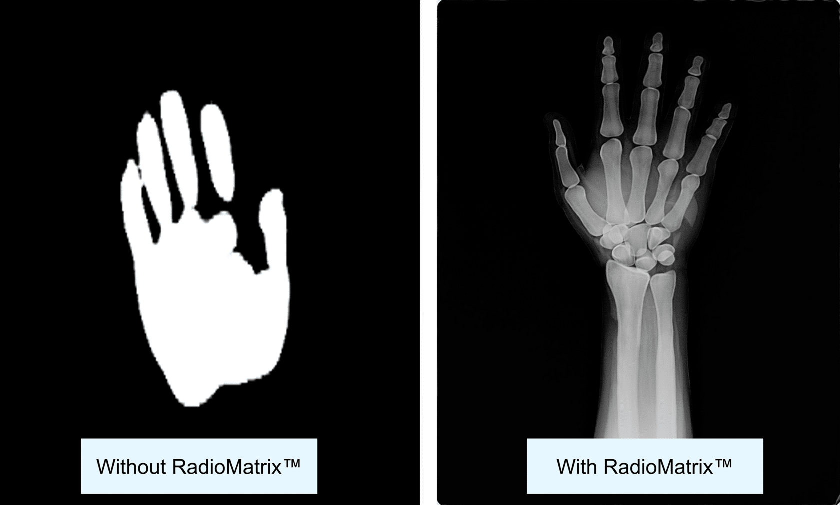 radiomatrix