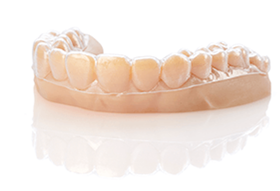 Modelo dental impreso en 3D