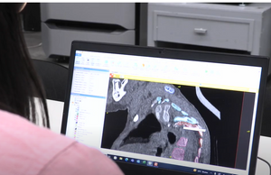 Segmentación médica con Synopsys Simpleware software