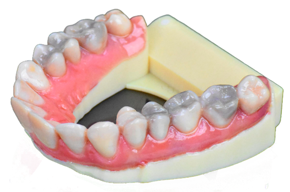 Modelo dental realista impreso en 3D