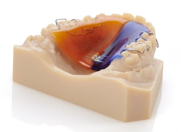 Modelo dental impreso en 3D con retenedor