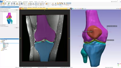 aplicaciones de segmentacion medica con Simpleware