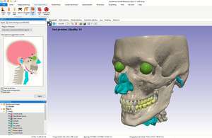 Synopsys Simpleware