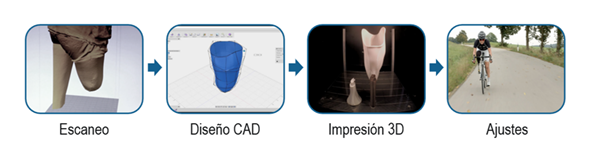 Proceso de creación 3D de una prótesis personalizada.